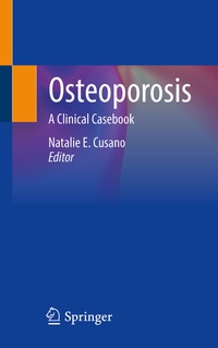 Abbildung von: Osteoporosis - Springer
