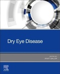 Cover: Dry Eye Disease - Elsevier