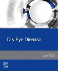 Abbildung von: Dry Eye Disease - Elsevier