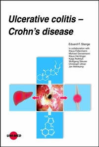 Abbildung von: Ulcerative colitis - Crohn's disease - UNI-MED Verlag AG