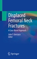 Cover: Displaced Femoral Neck Fractures - Springer