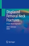 Cover: Displaced Femoral Neck Fractures - Springer