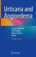 Cover: Urticaria and Angioedema - Springer