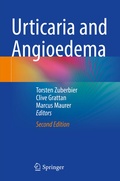 Cover: Urticaria and Angioedema - Springer