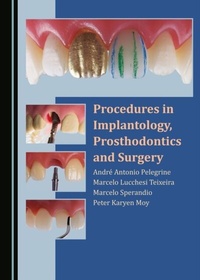 Abbildung von: Procedures in Implantology, Prosthodontics and Surgery - Cambridge Scholars Publishing