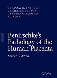 Abbildung von: Benirschke's Pathology of the Human Placenta - Springer