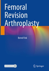Abbildung von: Femoral Revision Arthroplasty - Springer