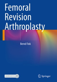 Abbildung von: Femoral Revision Arthroplasty - Springer