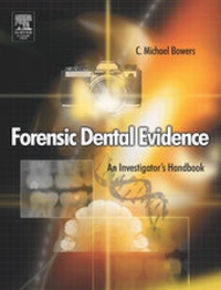 Abbildung von: Forensic Dental Evidence - Academic Press