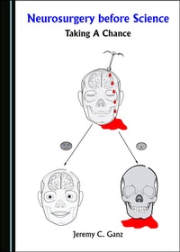 Abbildung von: Neurosurgery before Science - Cambridge Scholars Publishing