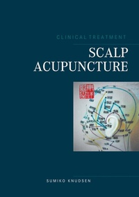 Abbildung von: Scalp Acupuncture - BoD - Books on Demand