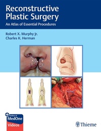 Enlarge image Cover: Reconstructive Plastic Surgery - Thieme Publishers