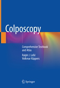Abbildung von: Colposcopy - Springer