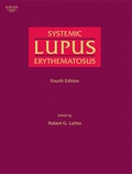 Cover: Systemic Lupus Erythematosus - Academic Press