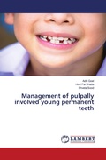 Cover: Management of pulpally involved young permanent teeth - LAP Lambert Academic Publishing