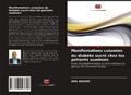 Cover: Manifestations cutan&eacute;es du diab&egrave;te sucr&eacute; chez les patients suadnais - Editions Notre Savoir