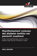 Cover: Manifestazioni cutanee del diabete mellito nei pazienti suadnesi - International Book Market Service Ltd