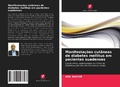 Cover: Manifesta&ccedil;&otilde;es cut&acirc;neas de diabetes mellitus em pacientes suadenses - Edi&ccedil;&otilde;es Nosso Conhecimento
