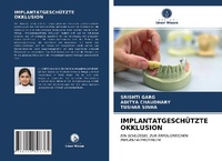Abbildung von: IMPLANTATGESCHÜTZTE OKKLUSION - Verlag Unser Wissen