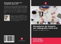 Cover: Receptores de imagem em radiografia intra-oral - Edicoes Nosso Conhecimento