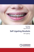 Cover: Self Ligating Brackets - LAP Lambert Academic Publishing