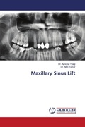 Cover: Maxillary Sinus Lift - LAP Lambert Academic Publishing