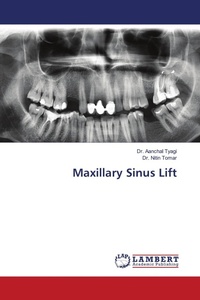 Enlarge image Cover: Maxillary Sinus Lift - LAP Lambert Academic Publishing