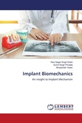 Cover: Implant Biomechanics - LAP Lambert Academic Publishing