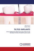 Cover: Tilted Implants - LAP Lambert Academic Publishing