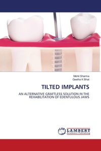 Enlarge image Cover: Tilted Implants - LAP Lambert Academic Publishing