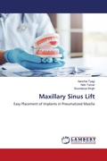Cover: Maxillary Sinus Lift - LAP Lambert Academic Publishing