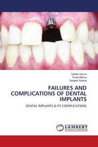 Enlarge image Cover: FAILURES AND COMPLICATIONS OF DENTAL IMPLANTS - LAP Lambert Academic Publishing