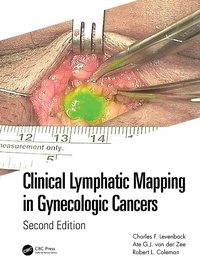 Abbildung von: Clinical Lymphatic Mapping in Gynecologic Cancers - CRC Press