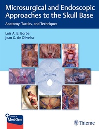 Abbildung von: Microsurgical and Endoscopic Approaches to the Skull Base - Thieme Publishers