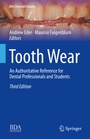 Cover: Tooth Wear - Springer