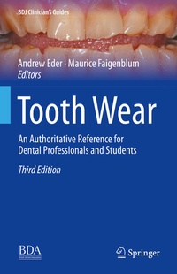 Enlarge image Cover: Tooth Wear - Springer