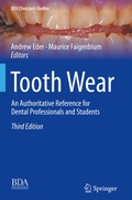 Cover: Tooth Wear - Springer