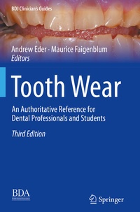 Enlarge image Cover: Tooth Wear - Springer