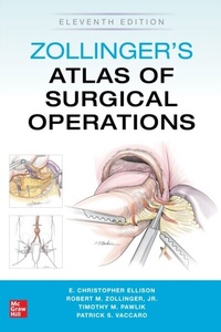 Abbildung von: Zollinger's Atlas of Surgical Operations, Eleventh Edition - McGraw Hill LLC