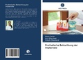 Cover: Prothetische Betrachtung der Implantate - Verlag Unser Wissen