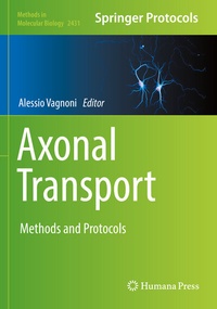 Abbildung von: Axonal Transport - Springer