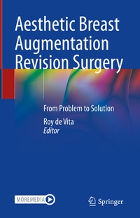 Abbildung von: Aesthetic Breast Augmentation Revision Surgery - Springer