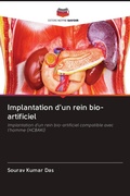 Cover: Implantation d'un rein bio-artificiel - Editions Notre Savoir