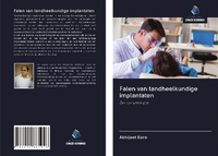 Abbildung von: Falen van tandheelkundige implantaten - Uitgeverij Onze Kennis