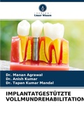 Cover: Implantatgestuetzte Vollmundrehabilitation - Verlag Unser Wissen