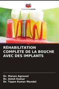 Cover: R&Eacute;HABILITATION COMPL&Egrave;TE DE LA BOUCHE AVEC DES IMPLANTS - Editions Notre Savoir