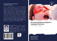 Abbildung von: Ispol'zowanie lazerow w parodontologii - Sciencia Scripts
