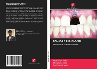 Abbildung von: FALHAS NO IMPLANTE - Edições Nosso Conhecimento