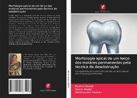 Abbildung von: Morfologia apical de um terço dos molares permanentes pela técnica de desobstrução - Edições Nosso Conhecimento