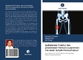 Cover: Ipsilaterale Fraktur des proximalen Femurs zusammen mit einer Schaft-Femurfraktur - Verlag Unser Wissen